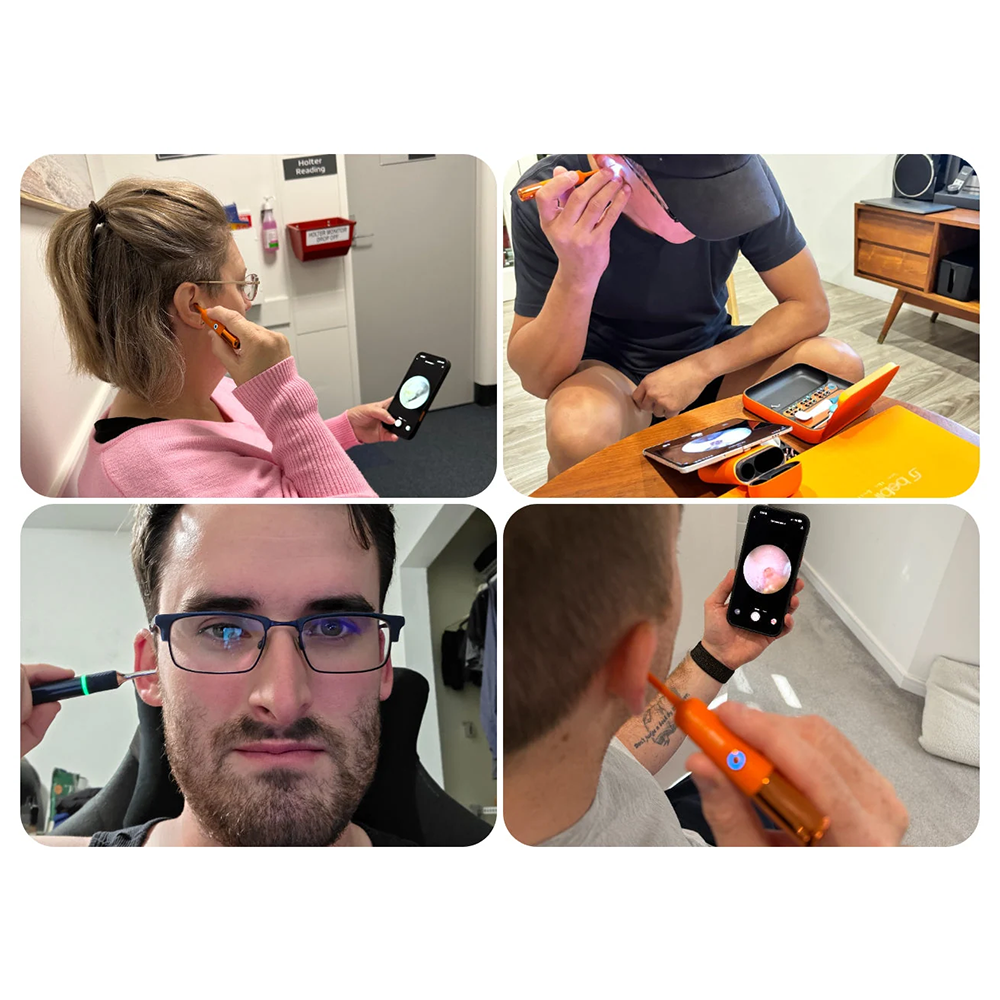 Does It Really Work? Real Bebird Ear Camera Before and After Results