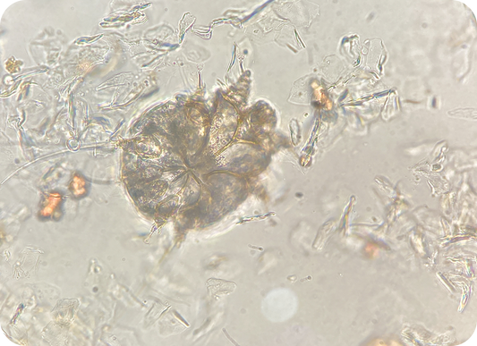 Ear mites under the microscope