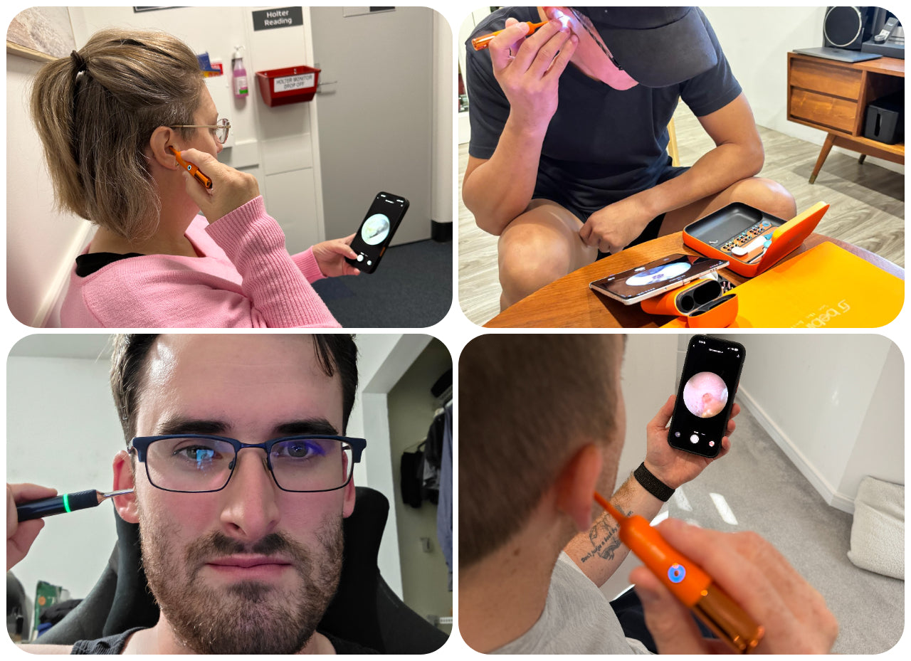 Does It Really Work? Real Bebird Ear Camera Before and After Results