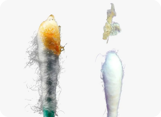 Wet vs Dry Earwax: What’s the Difference?