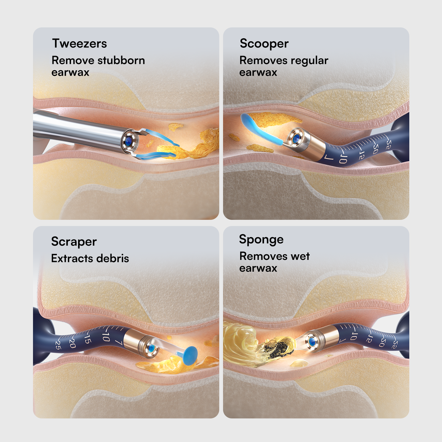 Bebird EarSight Plus Ear Spoon Replacement Tip Kit Earpick Attachments