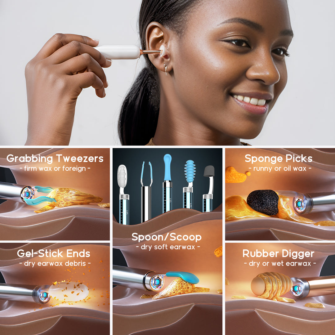 Bebird EarSight Complete Family Edition