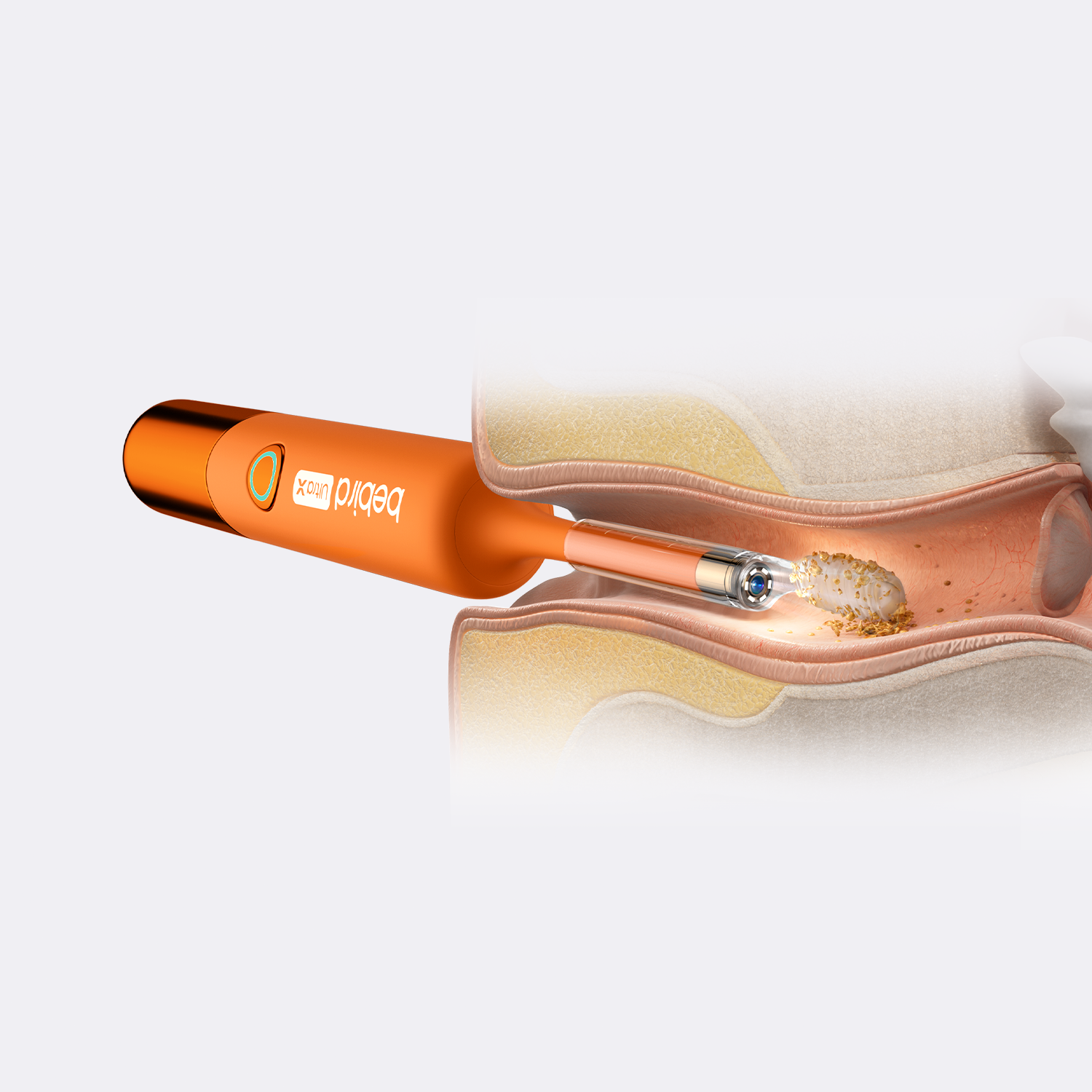 Bebird EarSight Ultra X(New Arrival)