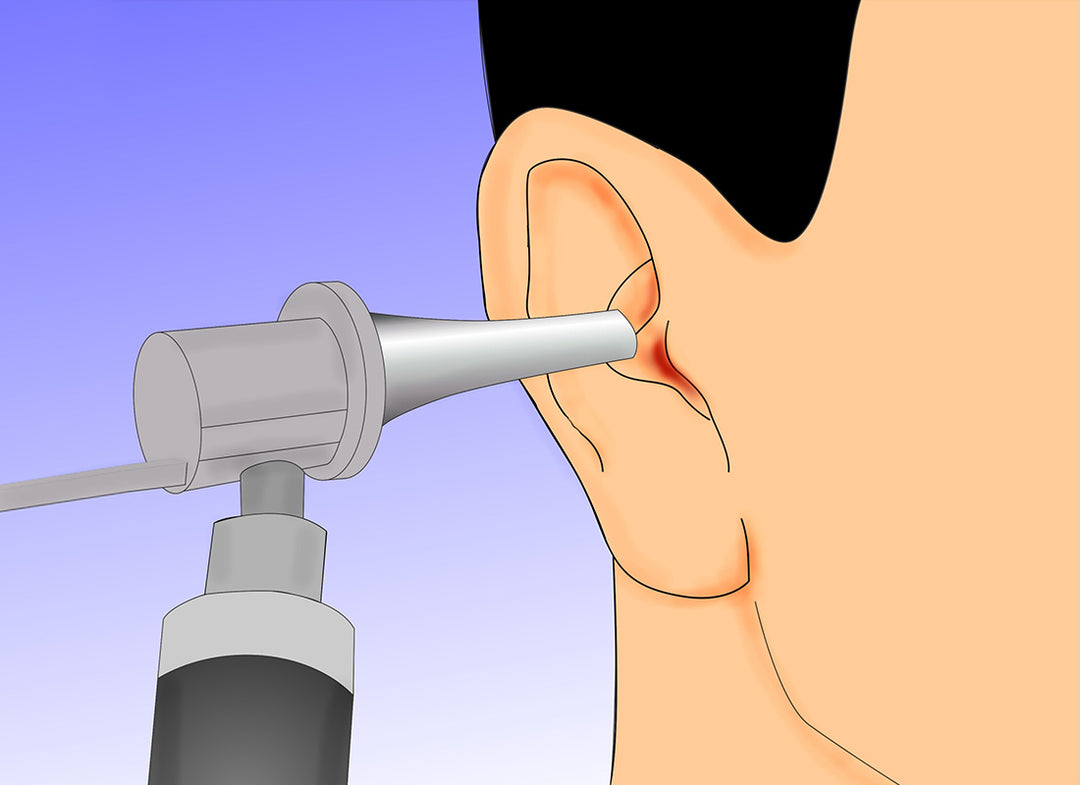 How Much Does it Cost to Get Your Ears Cleaned?