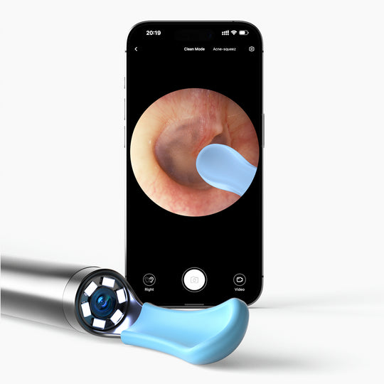 Bebird EarSight R1 Bundle