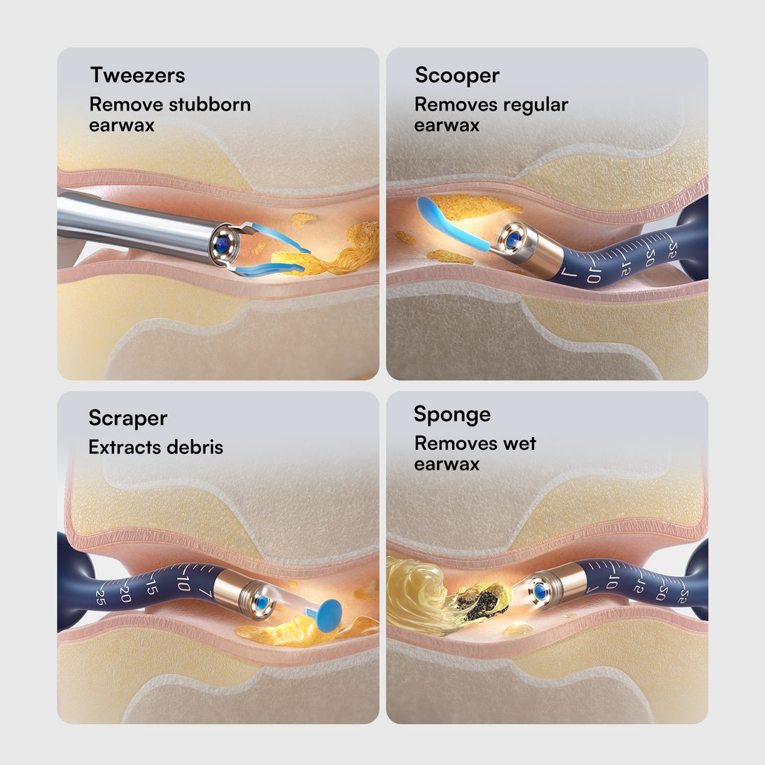 Bebird EarSight Plus Ear Spoon Replacement Tip Kit Earpick Attachments