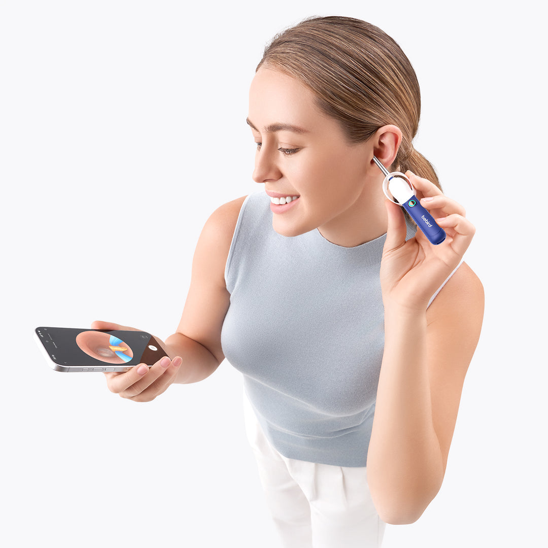 Bebird EarSight Plus