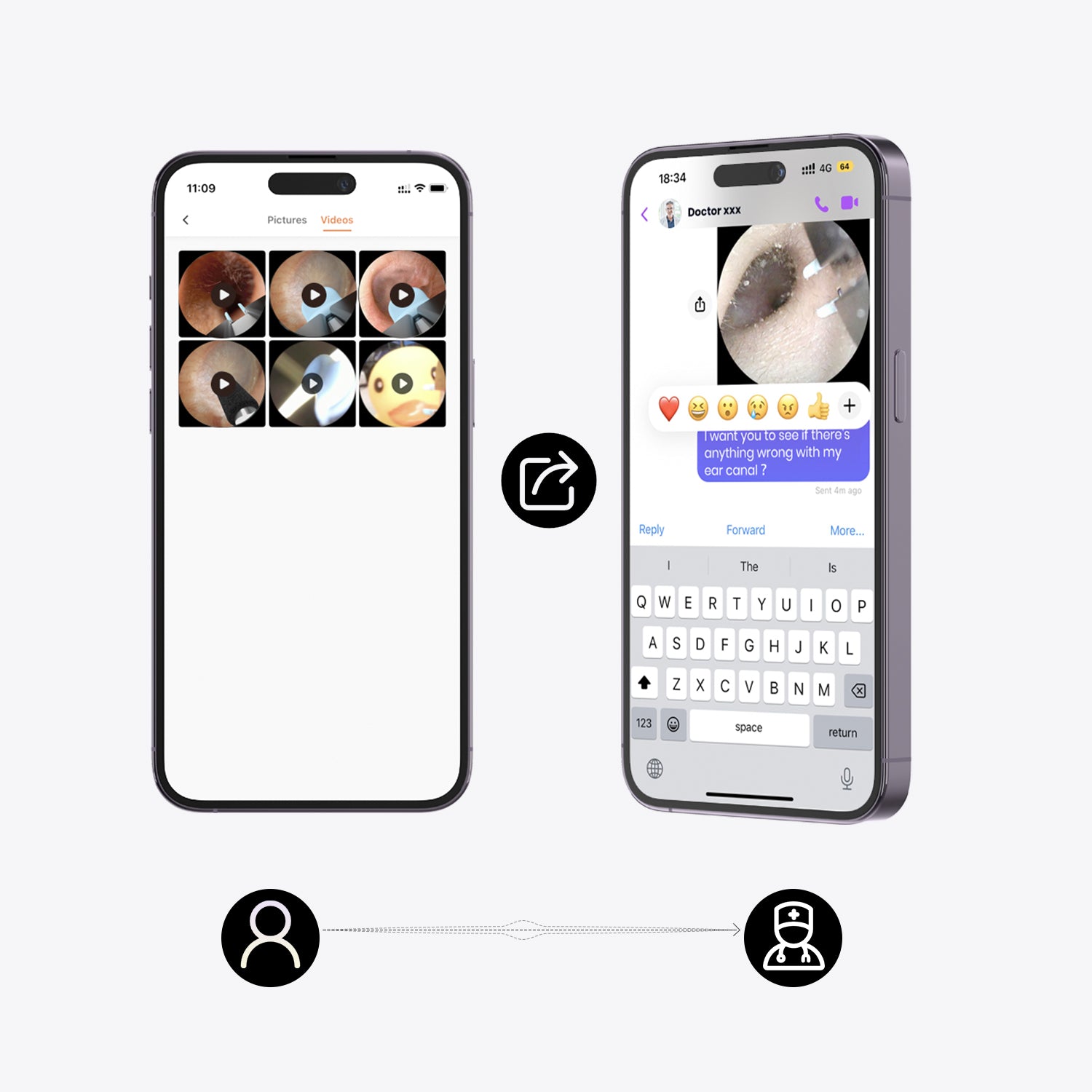 Bebird EarSight M9： Original Smart Ear Cleaning Tool