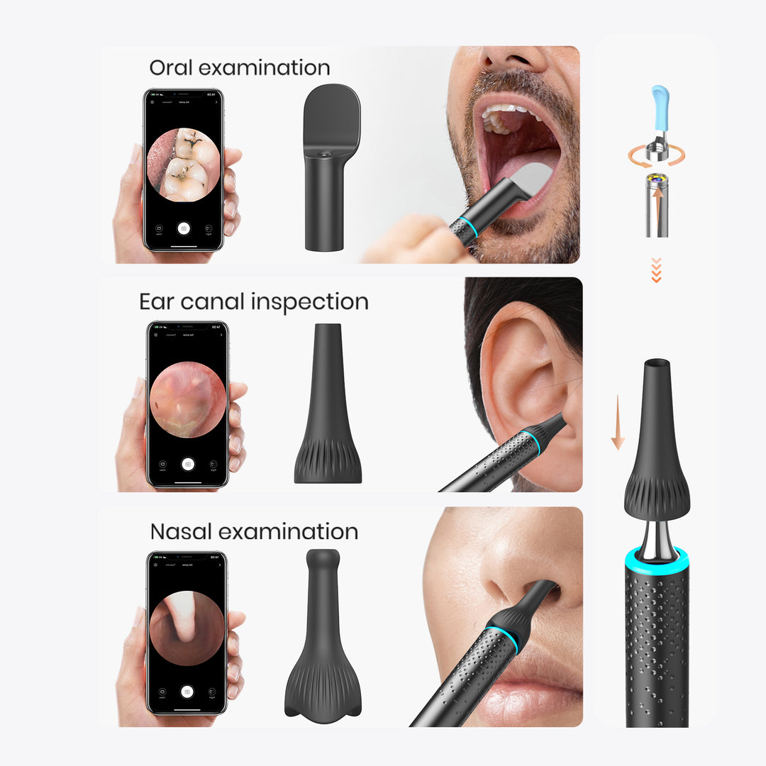 Bebird EarSight M9