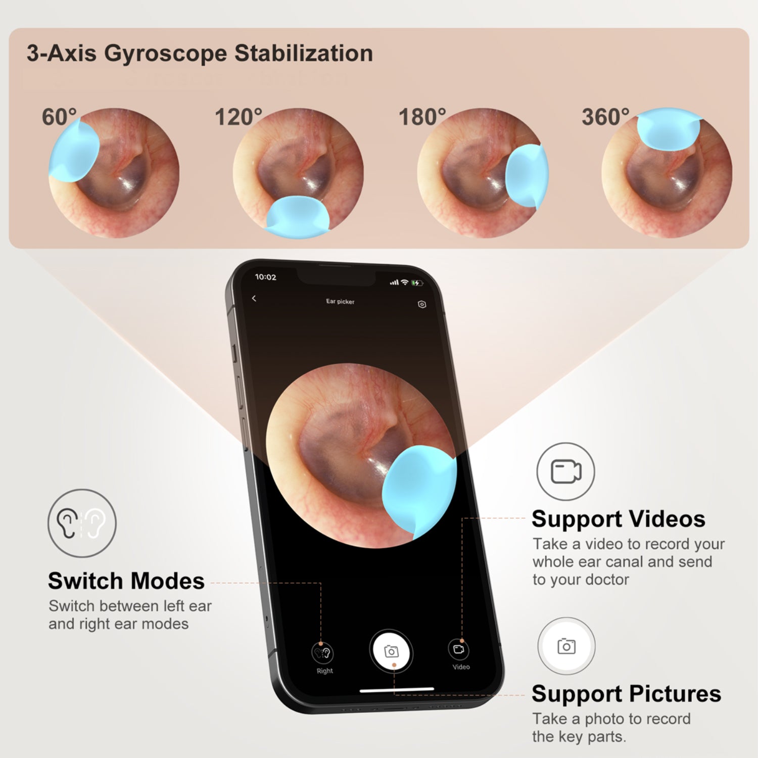 Bebird EarSight M9： Original Smart Ear Cleaning Tool