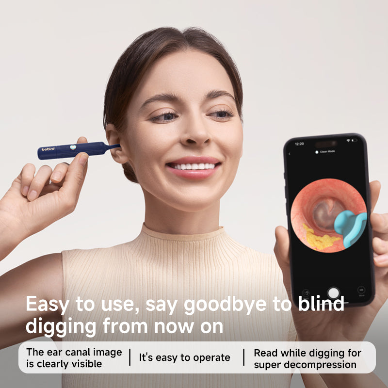 Bebird EarSight Plus