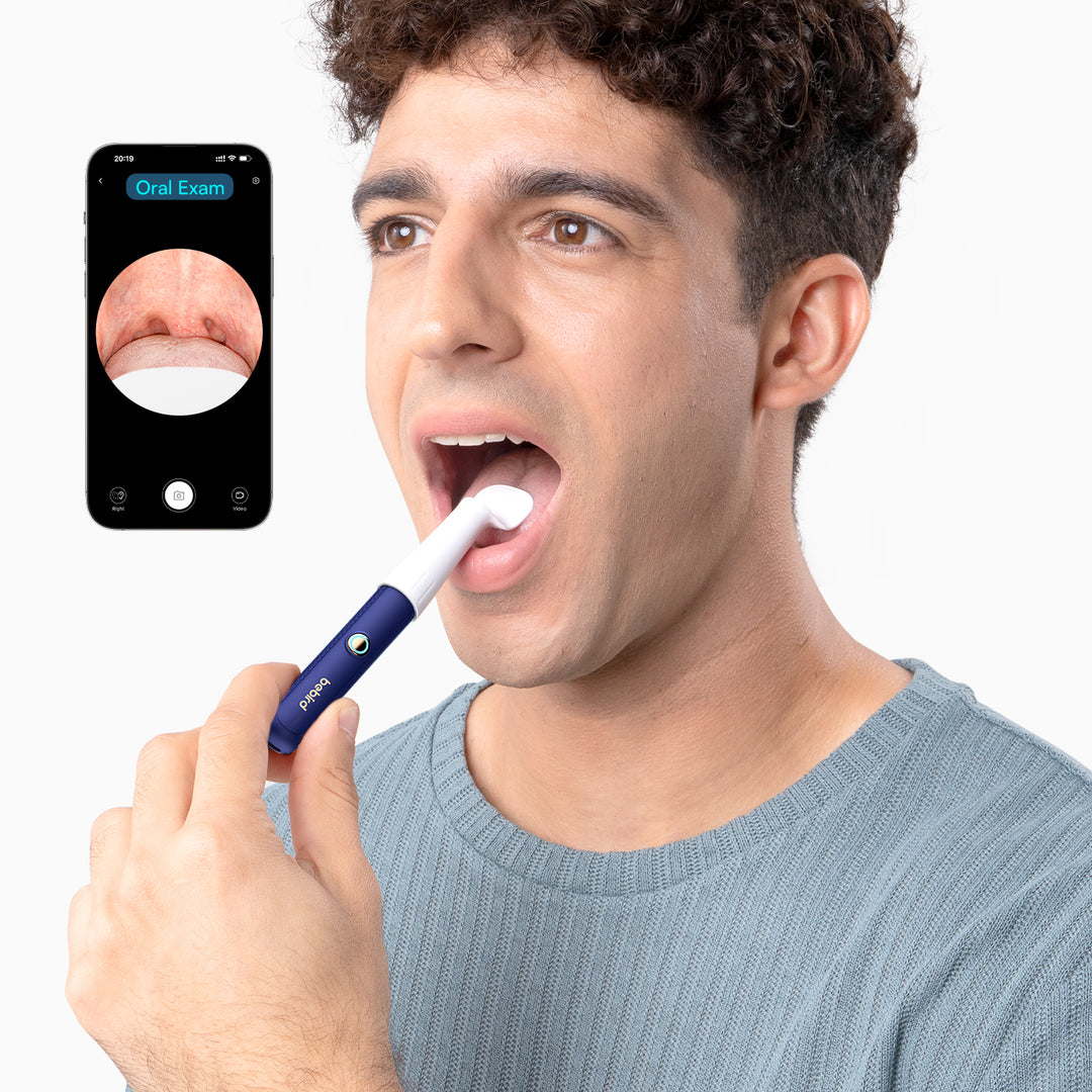Bebird EarSight Plus