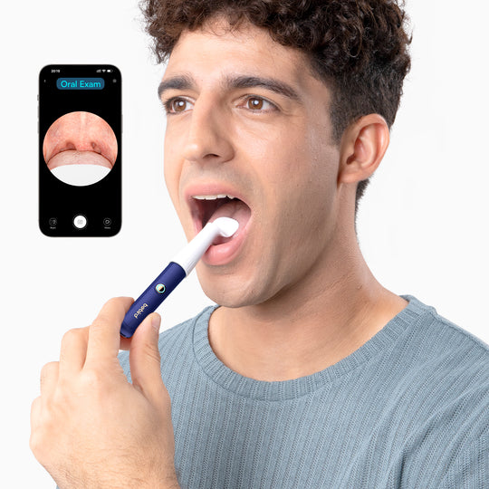 Bebird EarSight Plus