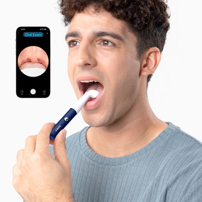 Bebird EarSight Plus – Smart Ear Wax Removal with Camera | FDA-Cleared